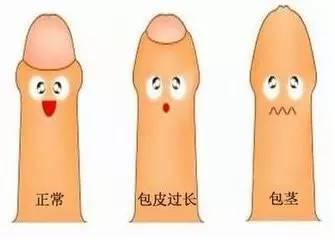 亚洲人阴茎为啥短小,揭秘亚洲人阴茎短小的成因与误解